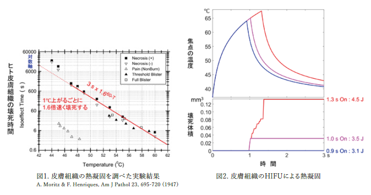 皮膚組織の熱凝固を調べた実験結果 皮膚組織のHIFUによる熱凝固
