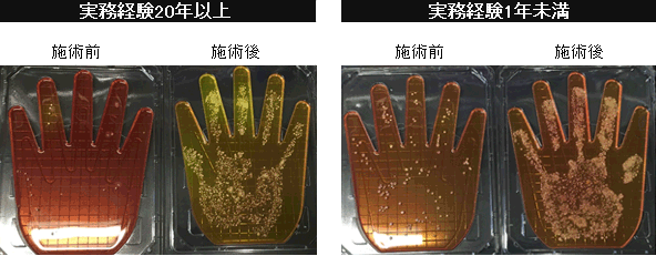技術者の手指最近調査